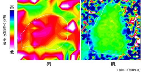 唇のあれやすさは細胞間脂質の密度の低さにあることを発見
唇あれを改善するリポソーム製剤を開発
PDF:622KB