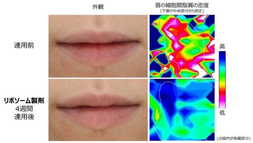 唇のあれやすさは細胞間脂質の密度の低さにあることを発見
唇あれを改善するリポソーム製剤を開発
PDF:622KB