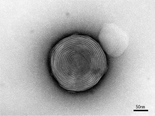 リポソームの電子顕微鏡像